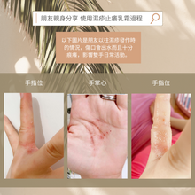 Load image into Gallery viewer, Eczema Anti-Itch Cream 濕疹止癢乳霜
