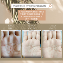 Load image into Gallery viewer, Eczema Anti-Itch Cream 濕疹止癢乳霜
