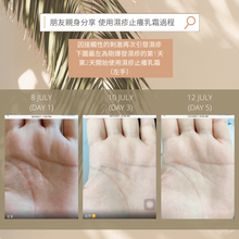 Load image into Gallery viewer, Eczema Anti-Itch Cream 濕疹止癢乳霜
