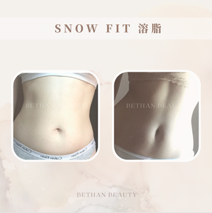 SNOW FIT 溶脂