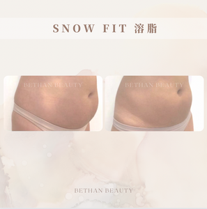 SNOW FIT 溶脂